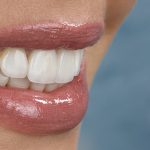 Crafting Picture-Perfect Smiles Through High-Precision Cosmetic Dental Care