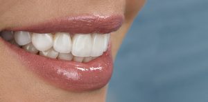 Crafting Picture-Perfect Smiles Through High-Precision Cosmetic Dental Care